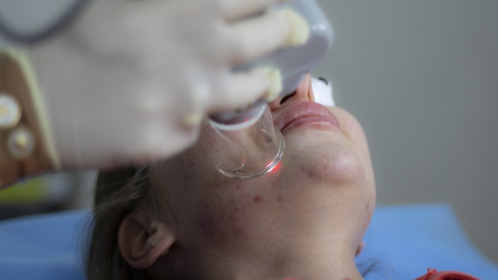 laser treatment for scar
