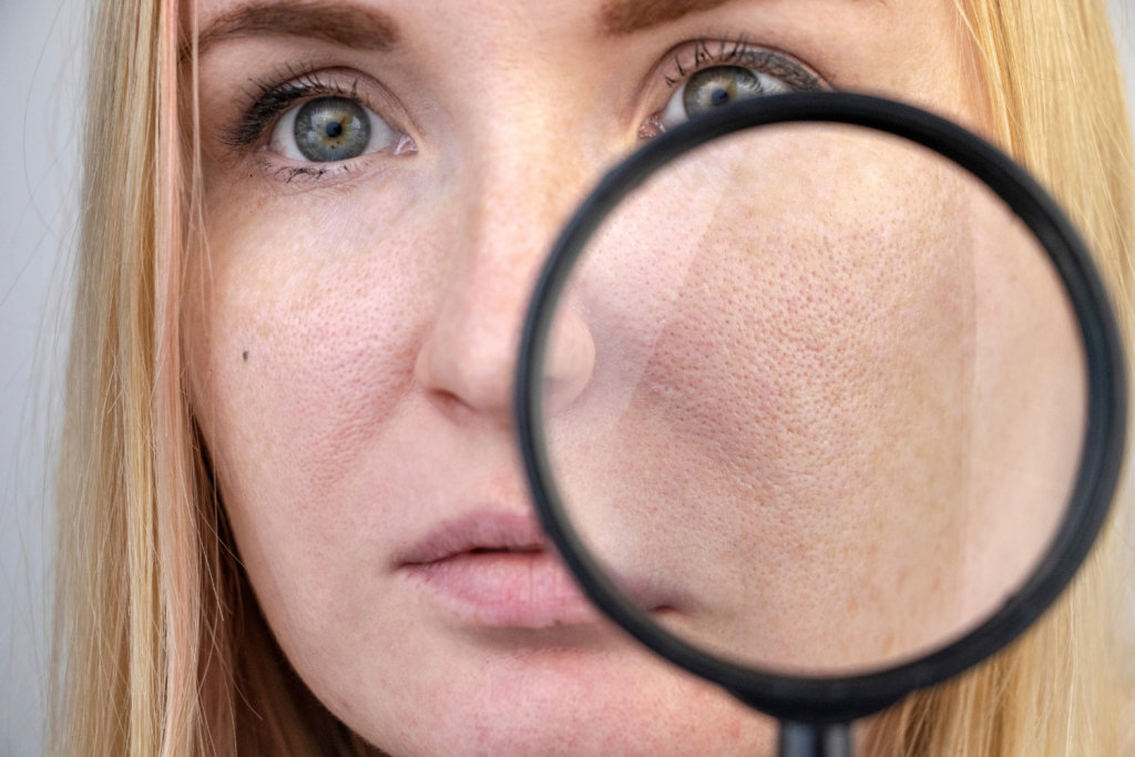 causes of pores