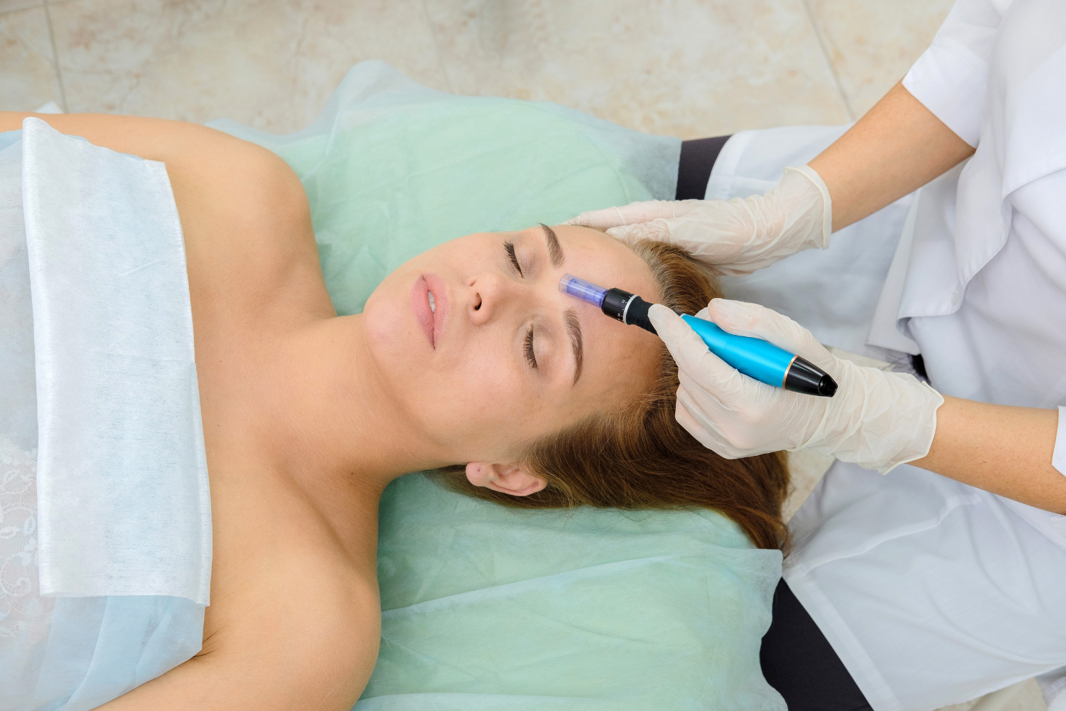 What Should You Do If You’re Getting A Micro-Needling Treatment?