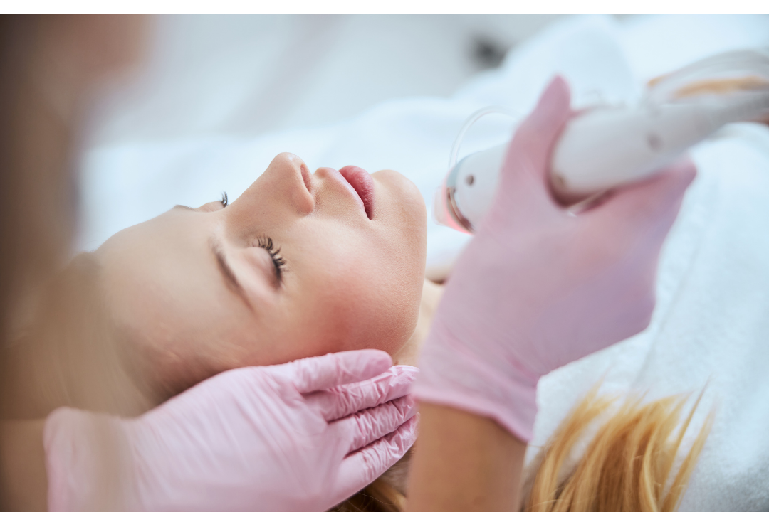 All You Need to Know About Microneedling Treatment