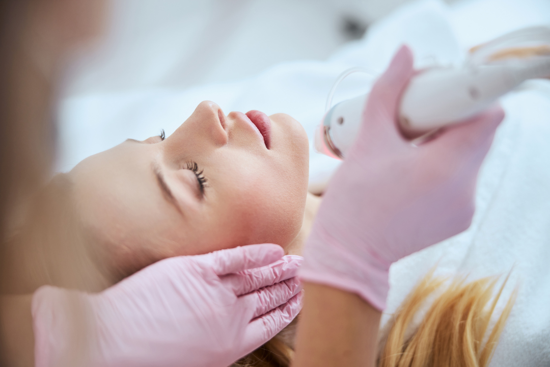 Is Micro-Needling Effective?